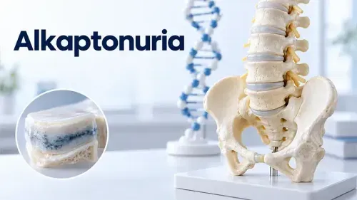 Alkaptonuria (Black Urine Disease)